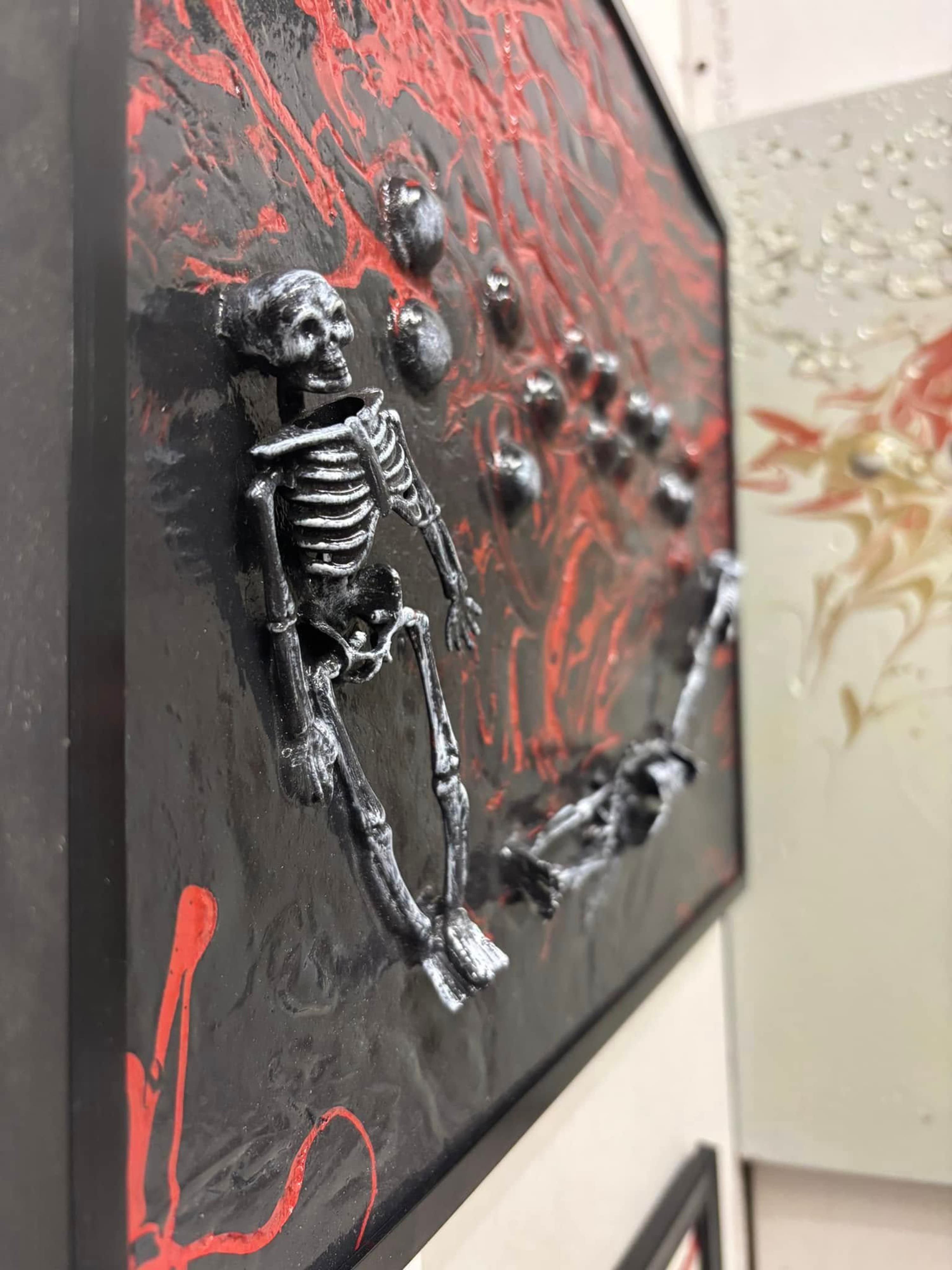 Enlarged Braille - bones - view 4