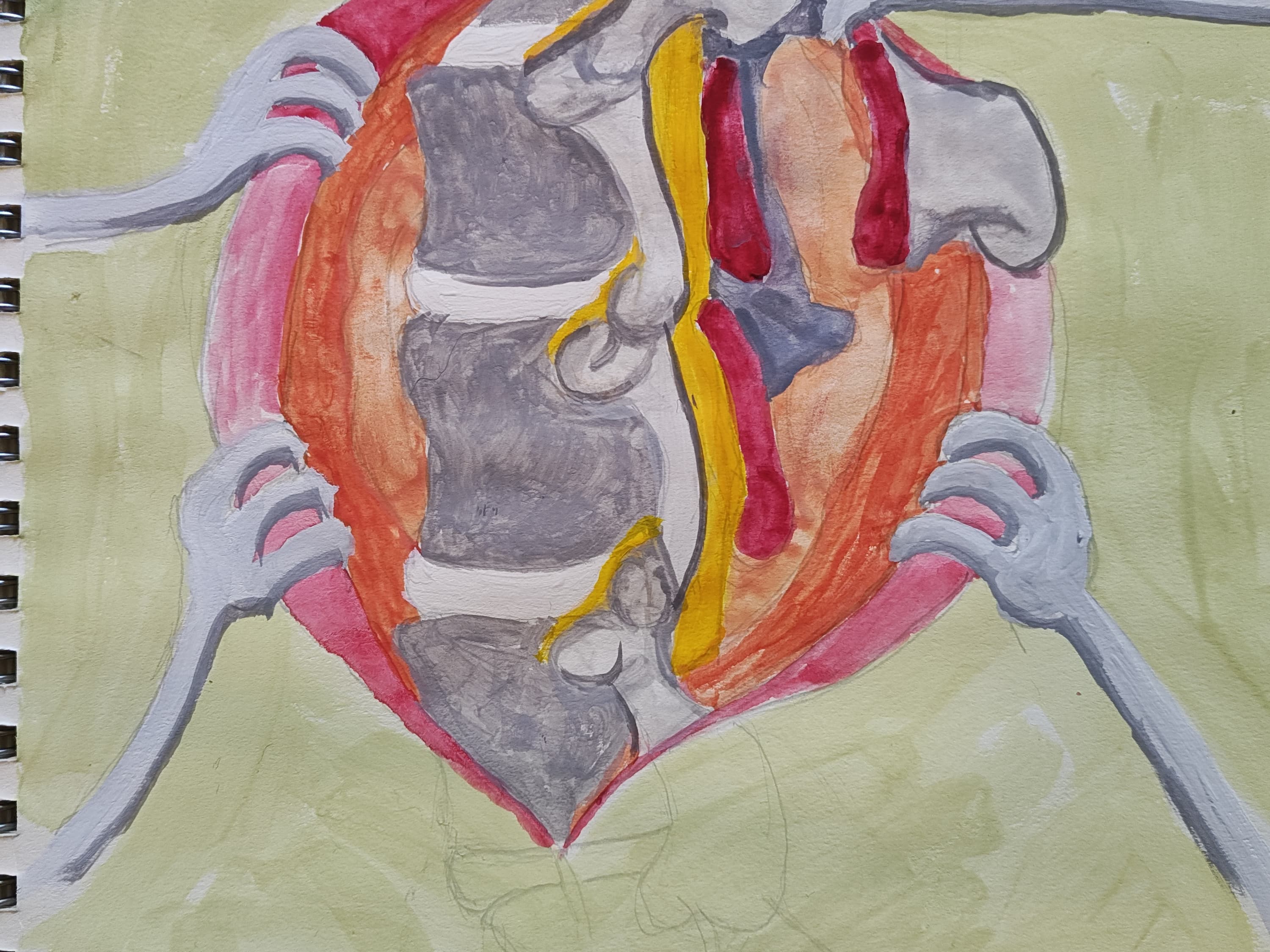 Welcome to my spinal surgery 