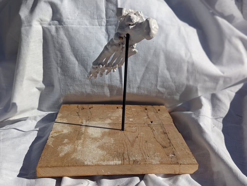 You Are Disabled OR Not Yet Disabled