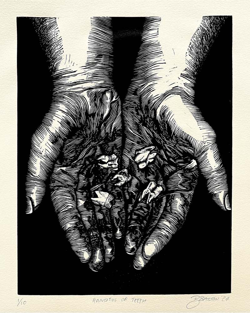 Handful of Teeth
